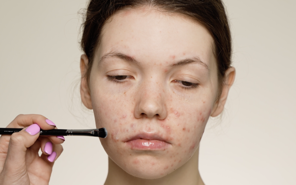 Правила макияжа для проблемной кожи