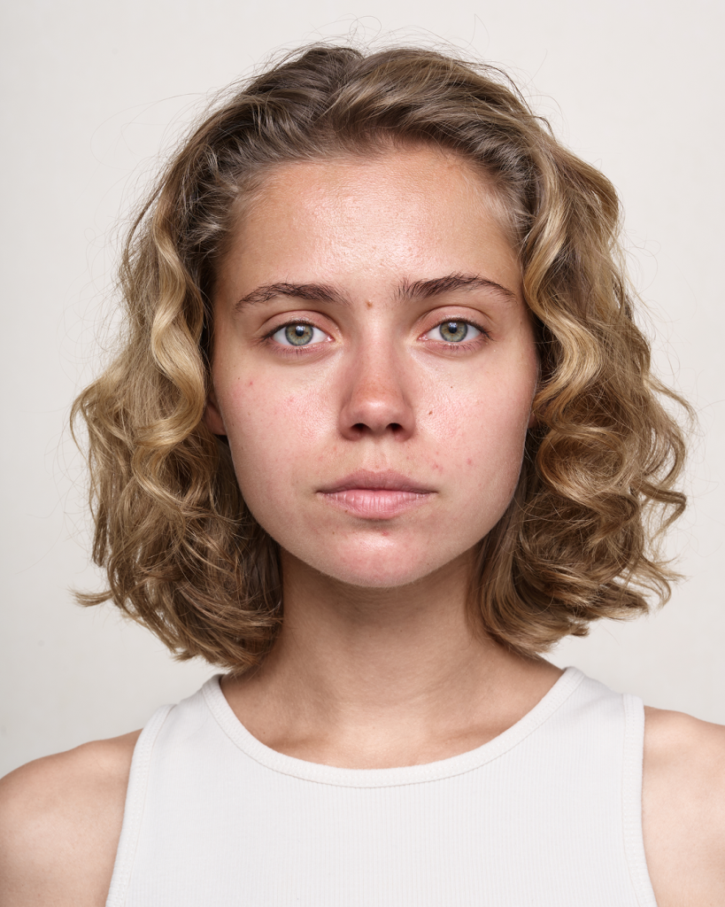 Косметика для проблемной кожи: какие компоненты подсушивают кожу и уменьшают воспаления Косметика для проблемной кожи: какие компоненты подсушивают кожу и уменьшают воспаления